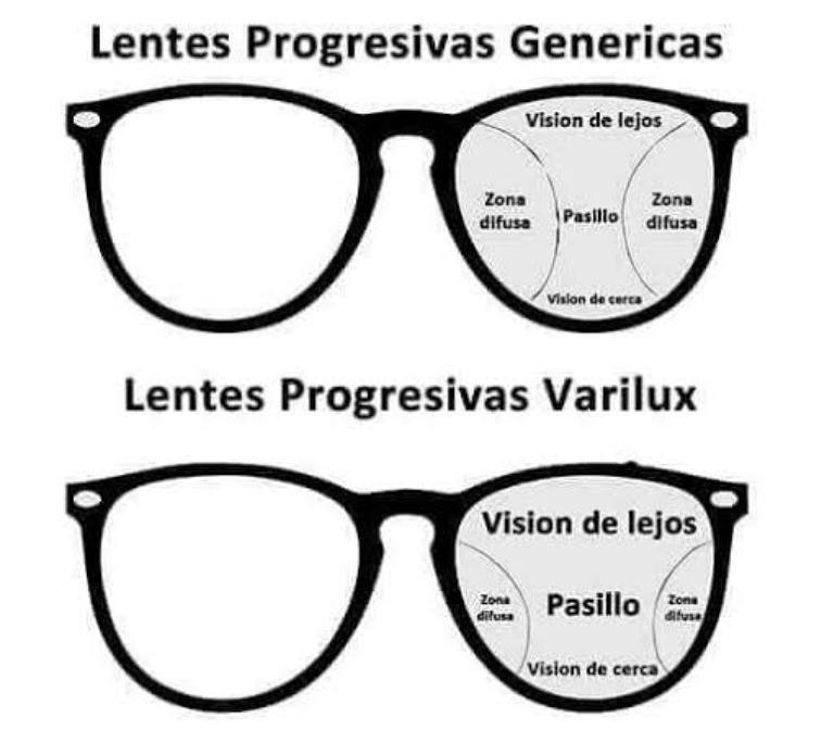 Retilens